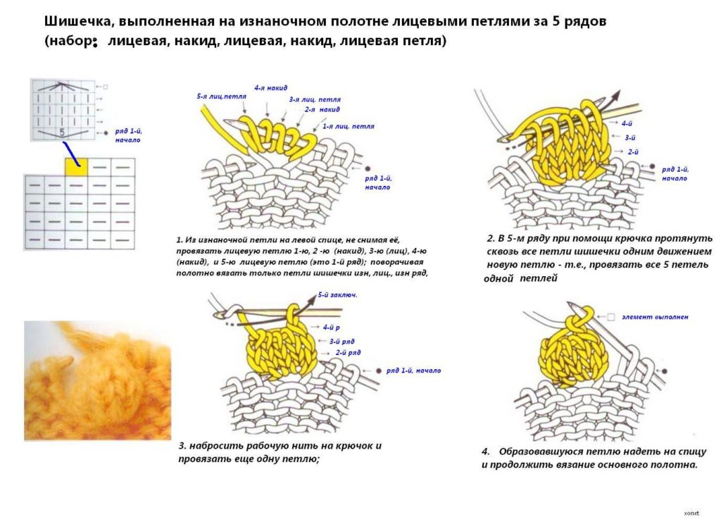 шишечки